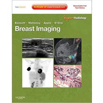 Breast Imaging: Expert Radiology Series, 1e