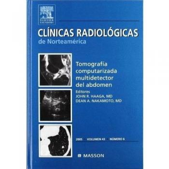 Clínicas Radiológicas de Norteamérica 2005. Volumen 43 n.º 6: Tomografía computarizada multidetector del abdomen