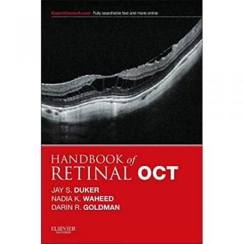 Handbook of Retinal OCT: Optical Coherence Tomography, 1e