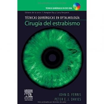 Cirugía del estrabismo