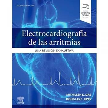Electrocardiografía de las arritmias: Una revisión exhaustiva