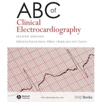 ABC of Clinical Electrocardiography