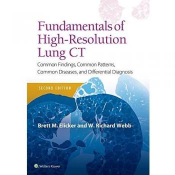 Fundamentals of High-Resolution Lung CT: Common Findings, Common Patterns, Common Diseases and Differential Diagnosis