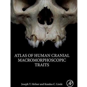 Atlas of Human Cranial Macromorphoscopic Traits