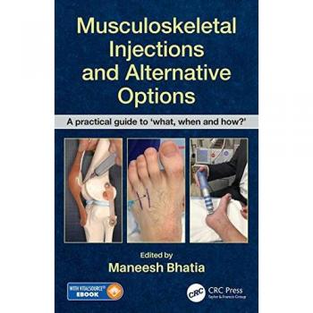 Musculoskeletal injections and alternative options a practical guide to what when and howz 2