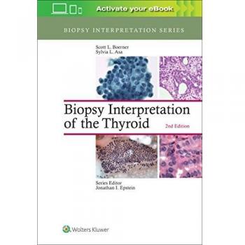 Thyroid Biopsy Analysis and Interpretation Guide