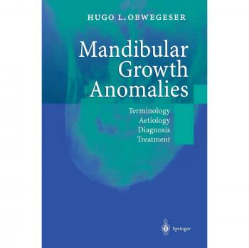Mandibular Growth Anomalies: Terminology, Aetiology, Diagnosis, and Treatment Guide