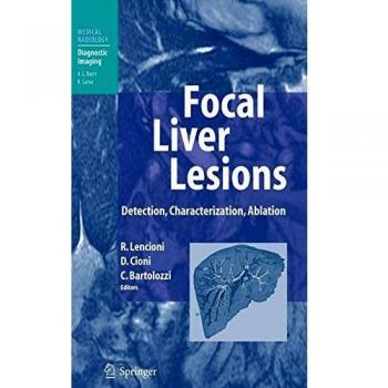 Focal Liver Lesions: Detection, Characterization, Ablation