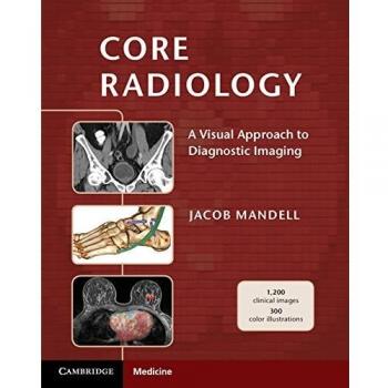Core Radiology: A Visual Approach to Diagnostic Imaging