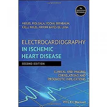 Electrocardiography in Ischemic Heart Disease: Clinical and Imaging Correlations and Prognostic Implications