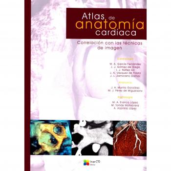 ATLAS DE IMAGEN CARDIACA
