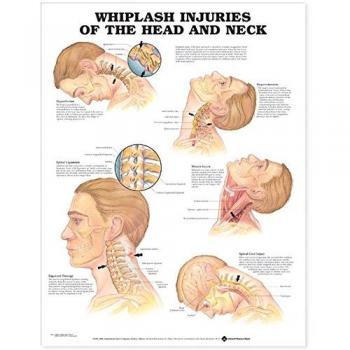 Lesiones por latigazo de cabeza y cuello