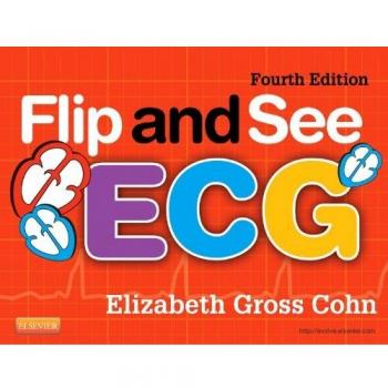 Flip and See ECG, 4e