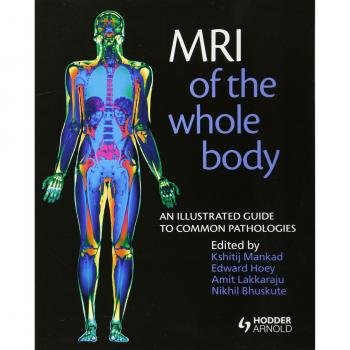 Comprehensive Whole Body MRI: Illustrated Guide to Common Pathologies