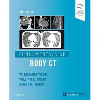 Fundamentals of Body CT, 5e