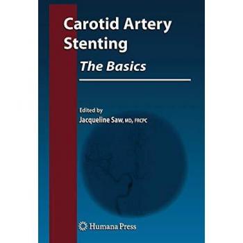 Carotid Artery Stenting: The Basics