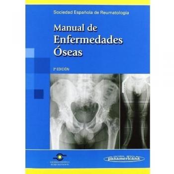 Manual de enfermedades oseas