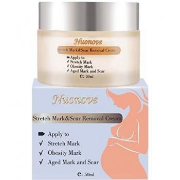 Crema Antiestrias Embarazo, Crema para Estrías, Eliminar Cicatrices del Embarazo, Stretch Marks Cream, Loción corporal, Crema Corporal Anti Estrías, Reparadora y cicatrizante estrías, 50ml