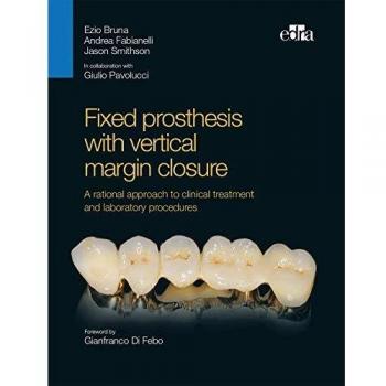 Fixed prosthesis with Vertical Margin Closure. A Rational Approach to Clinical Treatment and Laboratory Procedures