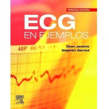 ECG en ejemplos