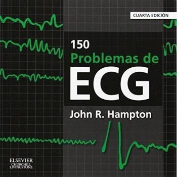 150 Problemas De ECG - 4ª Edición