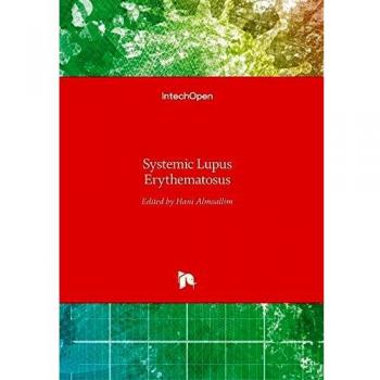Systemic Lupus Erythematosus