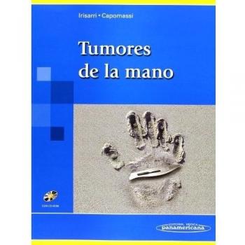 Tumores de la Mano
