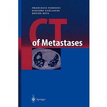 CT of Metastases