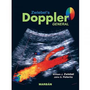 Doppler General