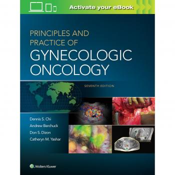 Principles and Practice of Gynecologic Oncology