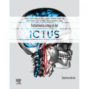 Tratamiento integral del ictus