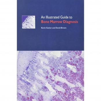 An Illustrated Guide to Bone Marrow Diagnosis