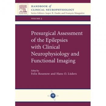 Presurgical Assessment of the Epilepsies with Clinical Neurophysiology and Functional Imaging: Handbook of Clinical Neurophysiology Series, Volume 3, 1e: v. 3