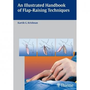 Thieme Illustrated Guide to Flap-Raising Techniques: A Comprehensive Handbook for Surgical Procedures