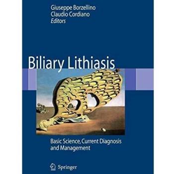 Biliary Lithiasis. Basic science, current diagnosis and management