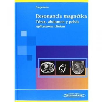 Resonancia magnetica