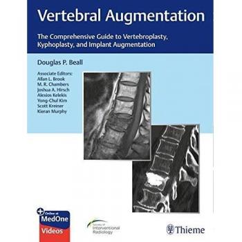Vertebral Augmentation: The Comprehensive Guide to Vertebroplasty, Kyphoplasty, and Implant Augmentation