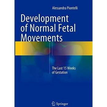 Development of Normal Fetal Movements: The Last 15 Weeks of Gestation