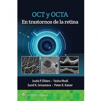 OCT Y OCTA EN TRASTORNOS DE LA RETINA