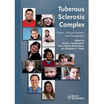 Tuberous Sclerosis Complex: Genes, Clinical Features and Therapeutics