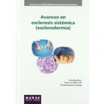Avances En Esclerosis Sistémica