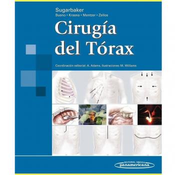 Cirugía del Tórax