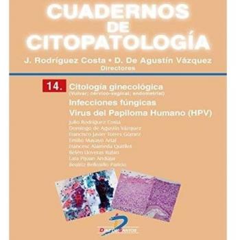 CITOLOGIA CERVICAL: INFECCIONES FÚNGICAS, VIRUS...
