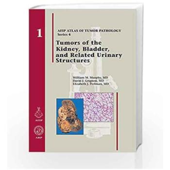 Tumors of the Kidney, Bladder, and Related Urinary Structures
