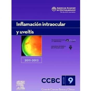 Inflamación Intraocular Y Uveítis. 2011-2012