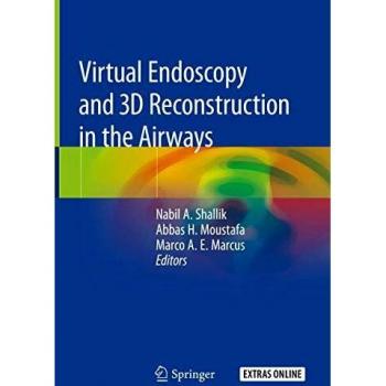 Virtual Endoscopy and 3D Reconstruction in the Airways