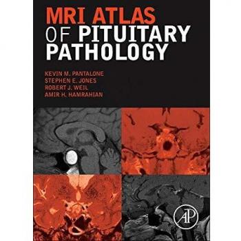 MRI Atlas of Pituitary Pathology