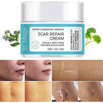 Scar Removal Cream, Scar Cream for Old Scars - Stretch Mark Removal Cream for Men & Women - Stretch Marks Relief and Burns Repair, Face Skin Repair Cream