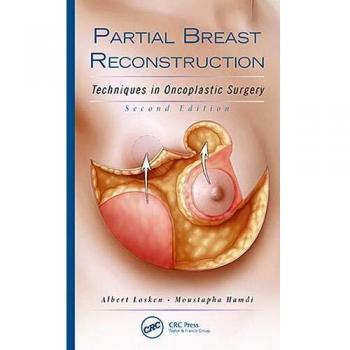 Partial Breast Reconstruction: Techniques in Oncoplastic Surgery