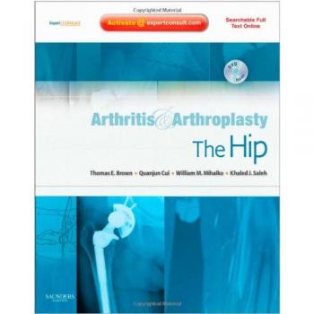 Arthritis and Arthroplasty: The Hip: Expert Consult - Online, Print and DVD, 1e